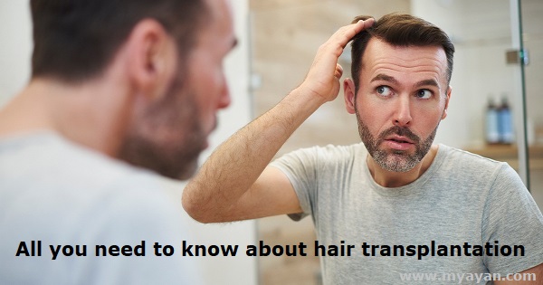 All You Need to Know about Hair Transplantation