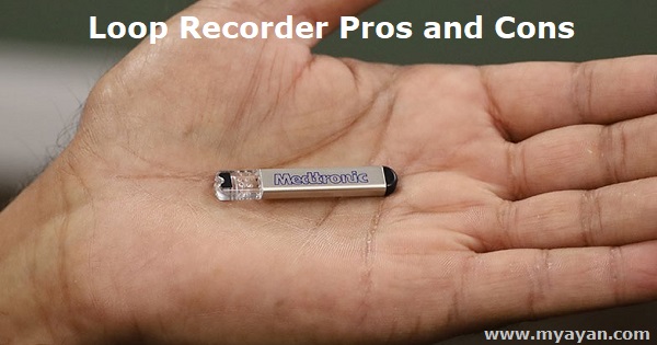 Loop Recorder Pros and Cons