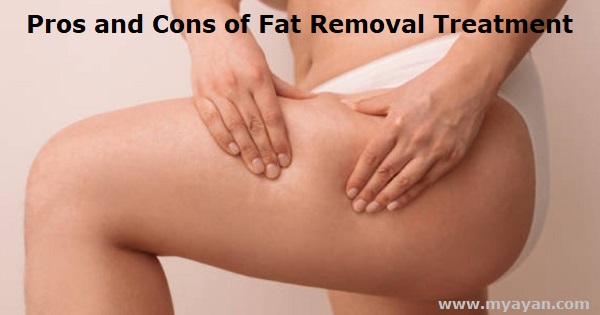 Pros and Cons of Fat Removal Treatment