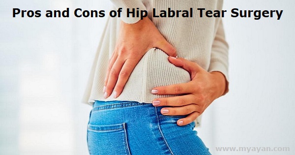 Pros and Cons of Hip Labral Tear Surgery