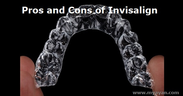Pros and Cons of Invisalign - Aligners - Braces
