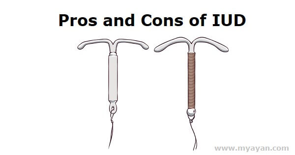 Pros and Cons of IUD