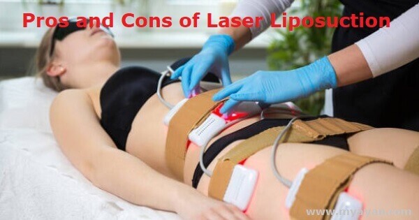 Pros and Cons of Laser Liposuction