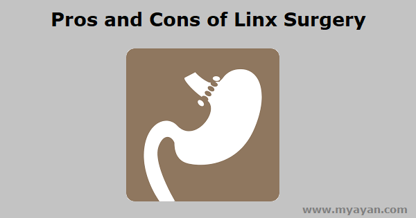 Pros and Cons of Linx Surgery