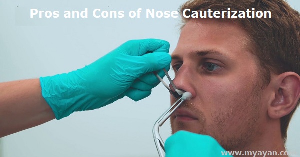 Pros and Cons of Nose Cauterization