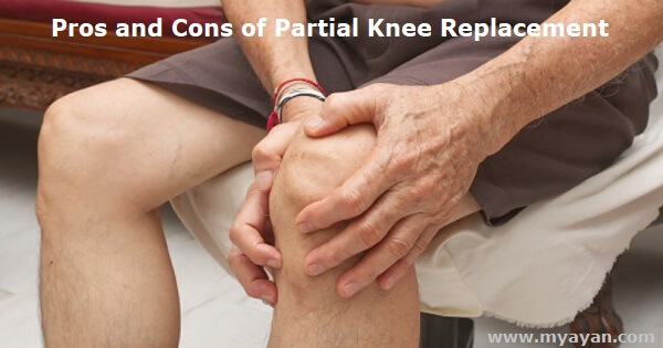 Pros and Cons of Partial Knee Replacement