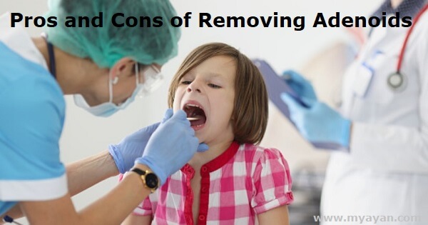 Pros and Cons of Removing Adenoids