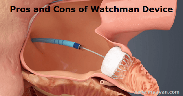 Pros and Cons of Watchman Device